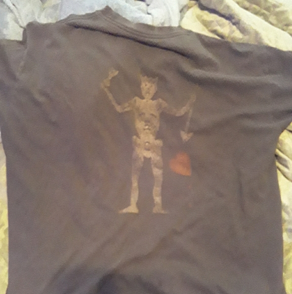 ST3-BP - Picture 1 of 2